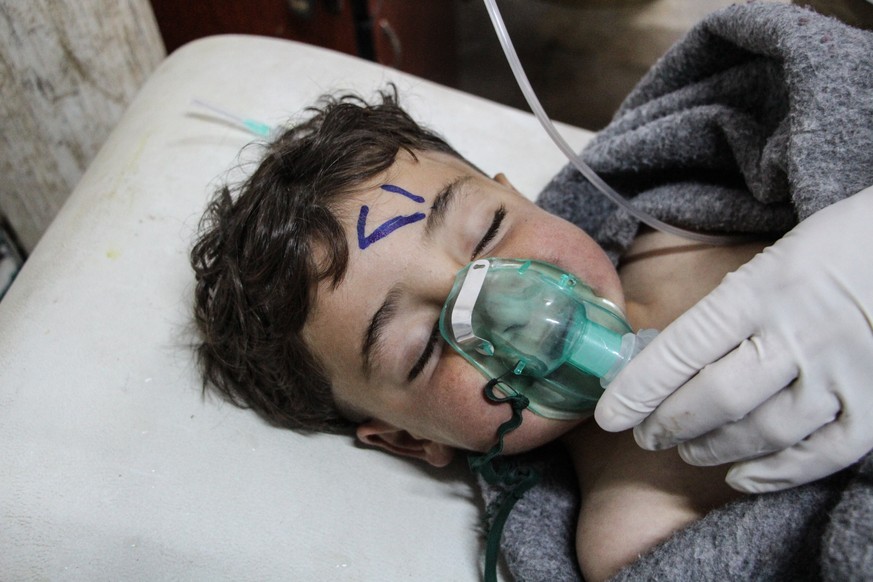 epaselect epa05887418 A Syrian child receives treatment after an alleged chemical attack at a field hospital in Saraqib, Idlib province, northern Syria, 04 April 2017. Media reports quoting the Britis ...