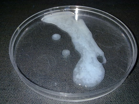 Menschliches Sperma, Samenflüssigkeit in Petri-Schale