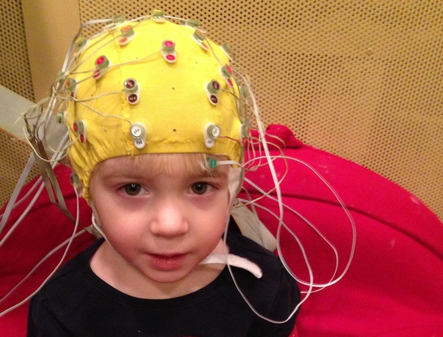 This undated handout photo provided by the Auditory Neuroscience Lab, Northwestern University, shows scalp electrodes to pick up how children&#039;s brains react to sounds such as speech in a noisy ba ...