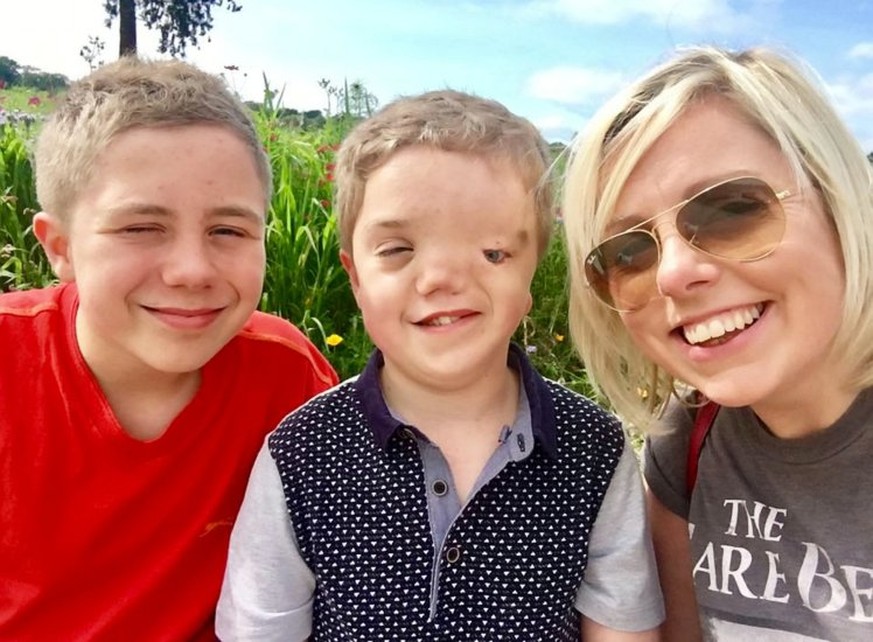 Mum Charlie Beswick, 38, with twins Harry Beswick (who has Goldenhar syndrome) and Oliver Beswick, 12. A mum has been left outraged after Instagram took down a photo of her son who has a facial deform ...