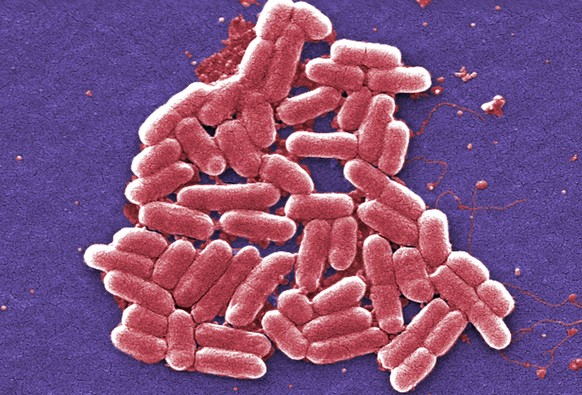 E.coli-Bakterien: Eine Frau in den USA wurde mit einem Erreger infiziert, beim dem jedes bekannte Antibiotikum versagt.