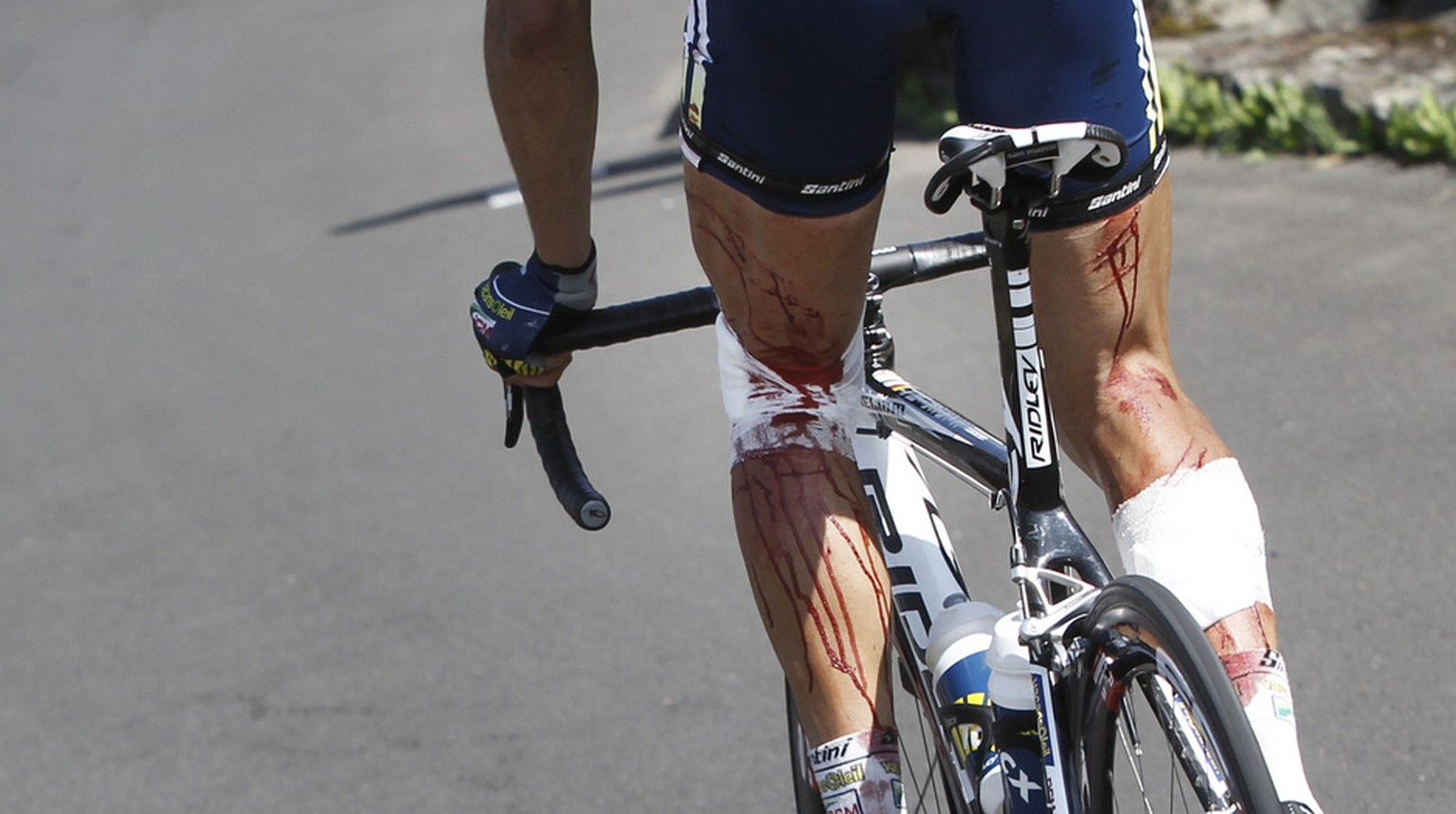 Injuries from barbed wire are seen on the legs of Johnny Hoogerland of The Netherlands as he rides towards Saint Flour during the 9th stage of the Tour de France cycling race over 208 kilometers (129  ...