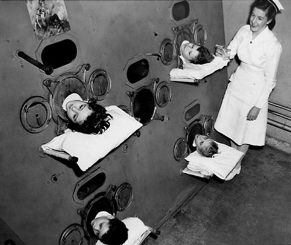 Unterdruckbeatmung mit einer «multipersonalen» Eisernen Lunge im Boston Kinderspital &nbsp;in den 1930ern.