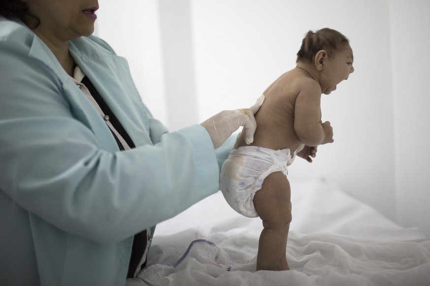 Verursacht durch das Zika-Virus:&nbsp;Kind aus Brasilien mit Mikrozephalie.&nbsp;