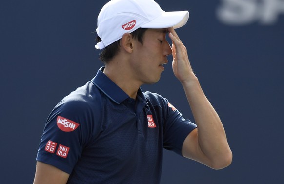 Kei Nishikori, of Japan, reacts to a lost point against Novak Djokovic, of Serbia, in the men&#039;s final of the Rogers Cup tennis tournament, Sunday, July 31, 2016, in Toronto. (Frank Gunn/The Canad ...