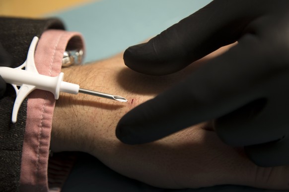 epa05887654 A picture made available on 04 March 2017 of David Holecek (L) getting a chip implanted in his hand by Jowan Osterlund of the company Biohax, in Gothenburg, Sweden, 02 December 2015. The m ...