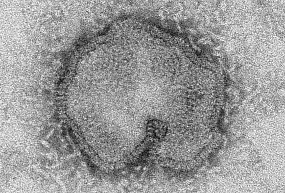 Der H7N9-Virus.