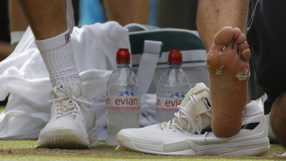 Croatia&#039;s Marin Cilic receives treatment to his foot during a medical timeout as he plays Switzerland&#039;s Roger Federer in the Men&#039;s Singles final match on day thirteen at the Wimbledon T ...
