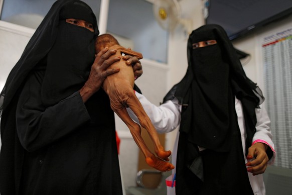 A woman holds her malnourished son at a malnutrition intensive care unit in the Red Sea port city of Houdeidah, Yemen November 17, 2016. Picture taken November 17, 2016. To match EXCLUSIVE YEMEN-FOOD/ ...