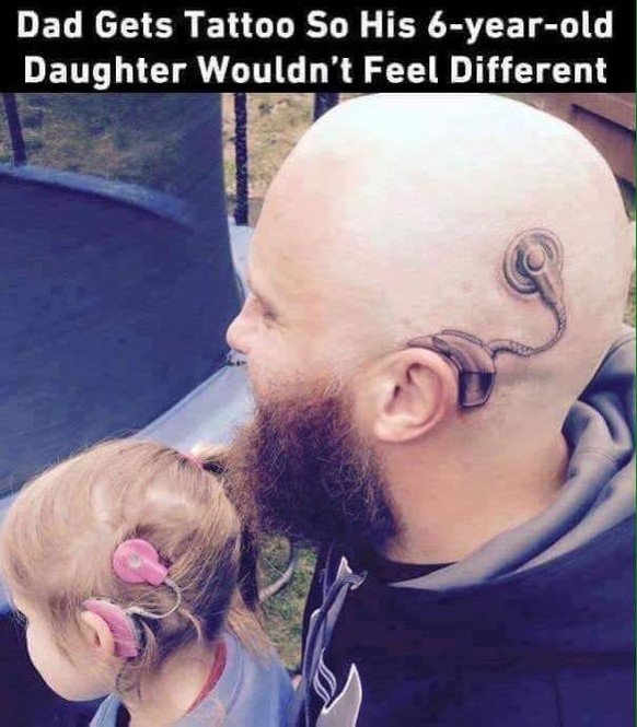 Der Vater liess sich ein Tattoo stechen, damit sich seine sechsjährige Tochter nicht anders fühlt.