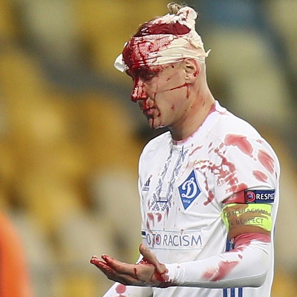 Dynamo Kiev&#039;s Domagoj Vida from Croatia leaves the field after being injured during the Group B Europa League soccer match between Dynamo Kiev and Young Boys at the Olympiyskiy stadium in Kiev, U ...