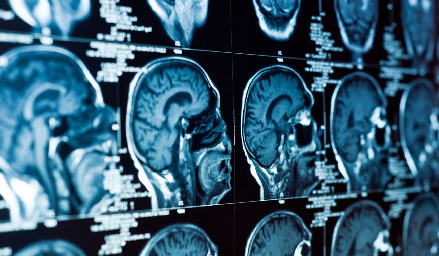 MRI-Aufnahme: Das menschliche Gehirn lässt sich trainieren.