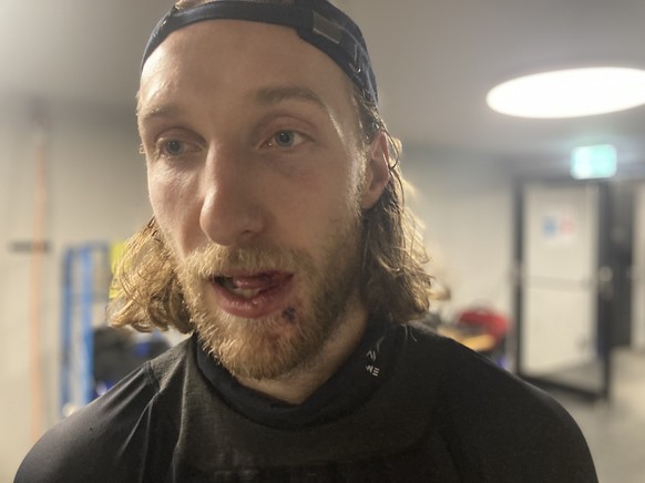 Nachrichten Linkding Jesse Zgraggen nach dem Spiel – vom Puck getroffen, die Wunde im Mund mit mehr als zehn Stichen genäht, zwei oder drei Zähne gelockert: So sieht Tapferkeit im Hockey aus.