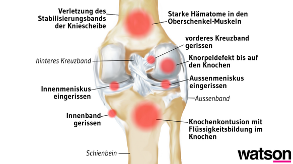 Ansicht eines Knies von hinten.