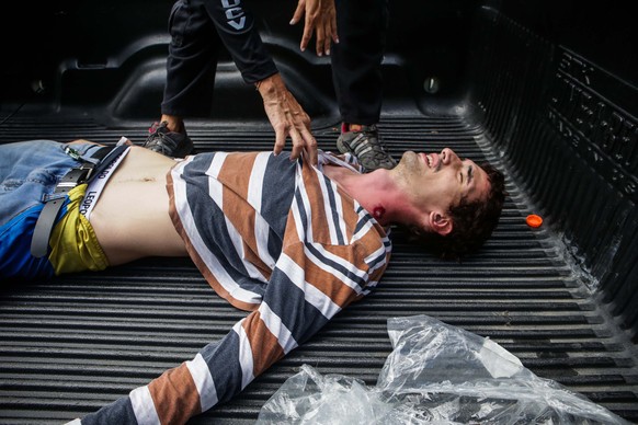 epa06118292 A wounded protestor receives medical assitance from emergency staff during a demonstration against the vote for a Constituent Assembly in Caracas, Venezuela, 30 July 2017. The National Con ...