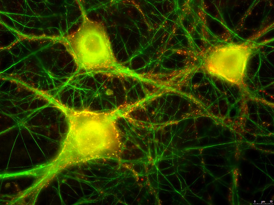 Vergrösserung der neuronalen Kultur. In grün sind wiederum Strukturen der Neuronen ersichtlich. Die gelben und roten Punkte zeigen die «Angriffspunkte» des Botulinumtoxins (Rezeptoren), an denen es an ...