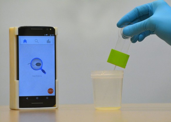 The smartphone-based semen analyzer tests for male infertility in seconds from the privacy of home with a 3D-printed setup costing less than $5, which can analyze most semen samples in less than 5 sec ...