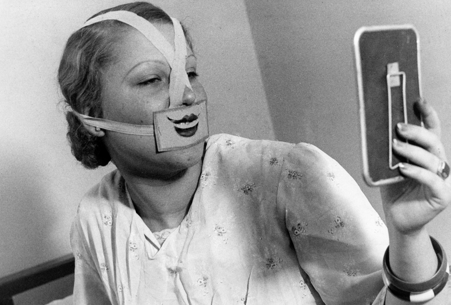 Op de Glimlach-school in Boedapest bekijkt een vrouw met een getekende mond voor haar gezicht gebonden zichzelf in een handspiegel. Hongarije 1937.