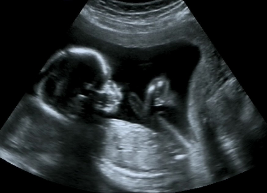 kind embryo schwanger