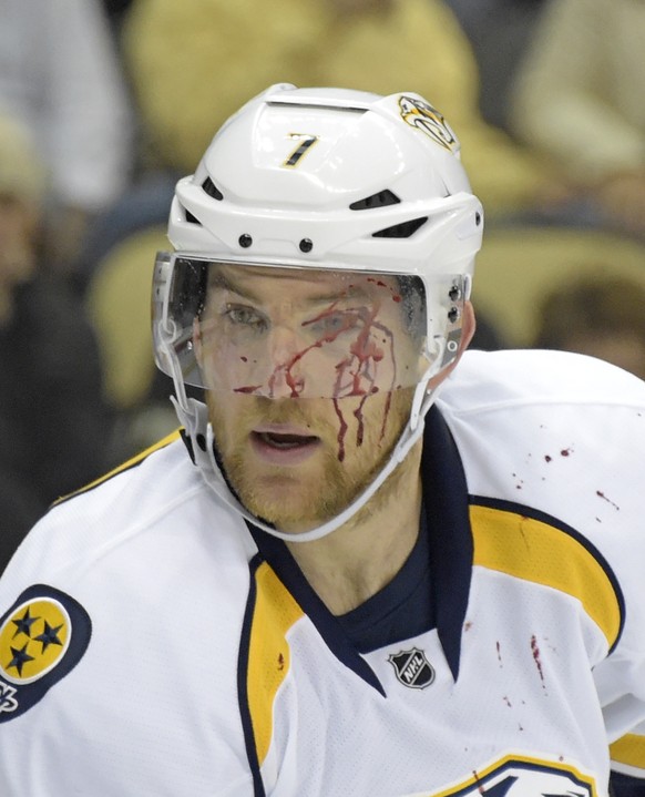 Blood trickles down the face of Nashville Predators defenseman Yannick Weber after he was struck in the face by the puck during the second period of the team&#039;s NHL hockey game against the Pittsbu ...