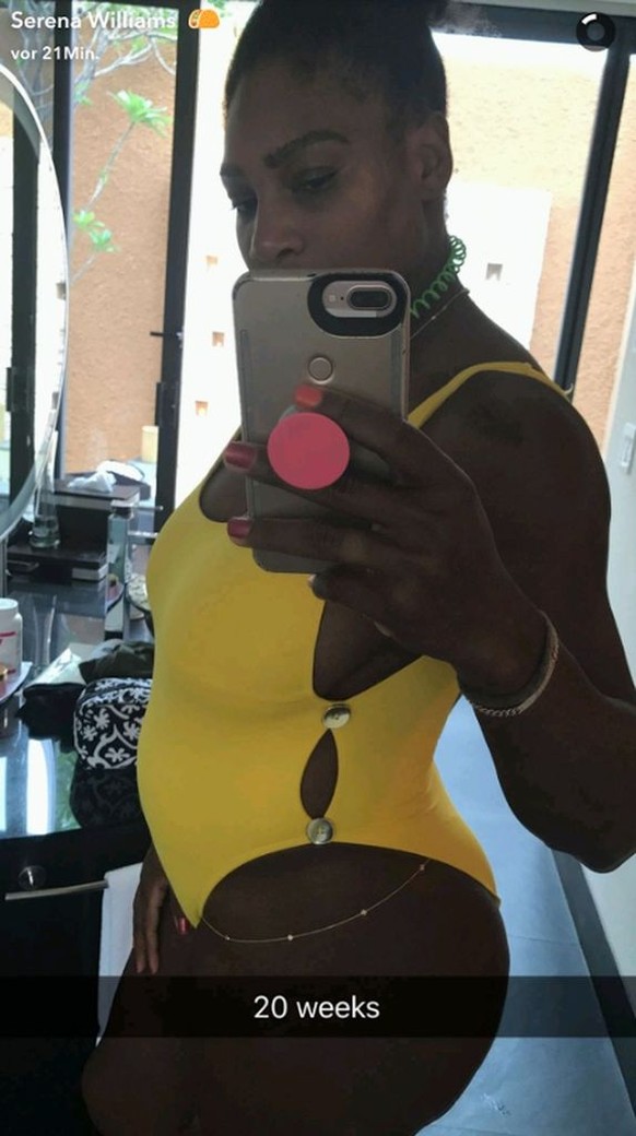 Serena Williams schwanger