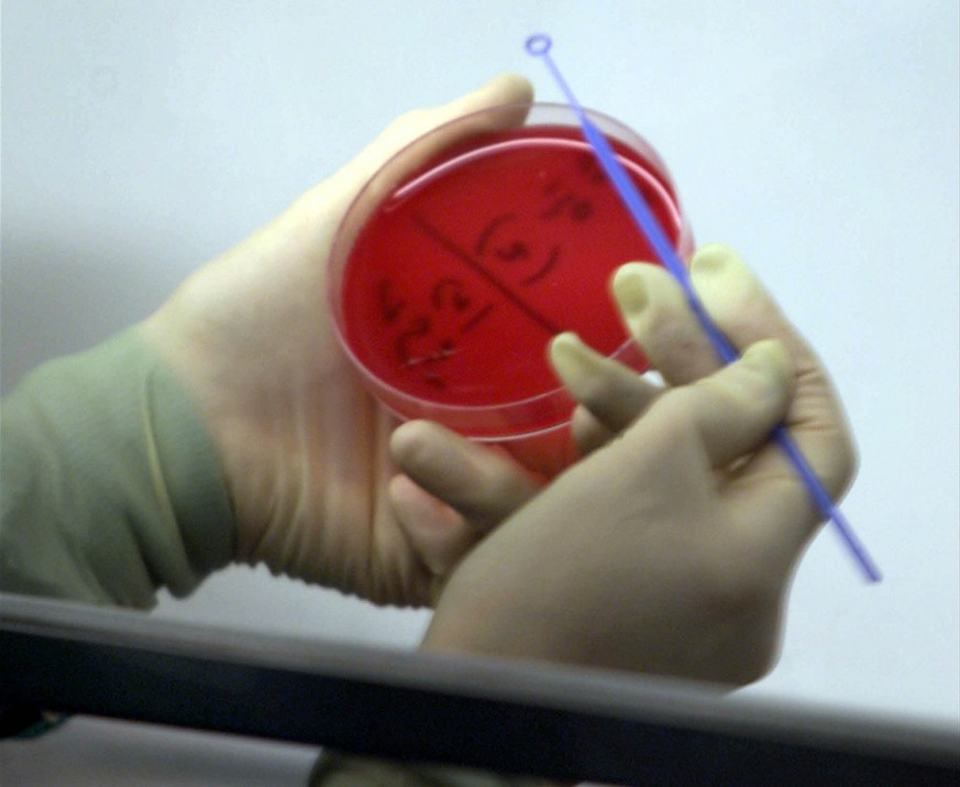 A doctor examines a sample at the micro-biological-laboratory of the university of the western German city of Cologne on Friday, October 19, 2001. The employees of laboratory test objects that may be  ...