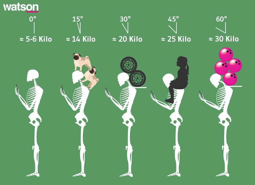 Die Grafik zeigt, welchen Belastungen unser Nacken bei der Smartphone-Nutzung ausgesetzt ist.
