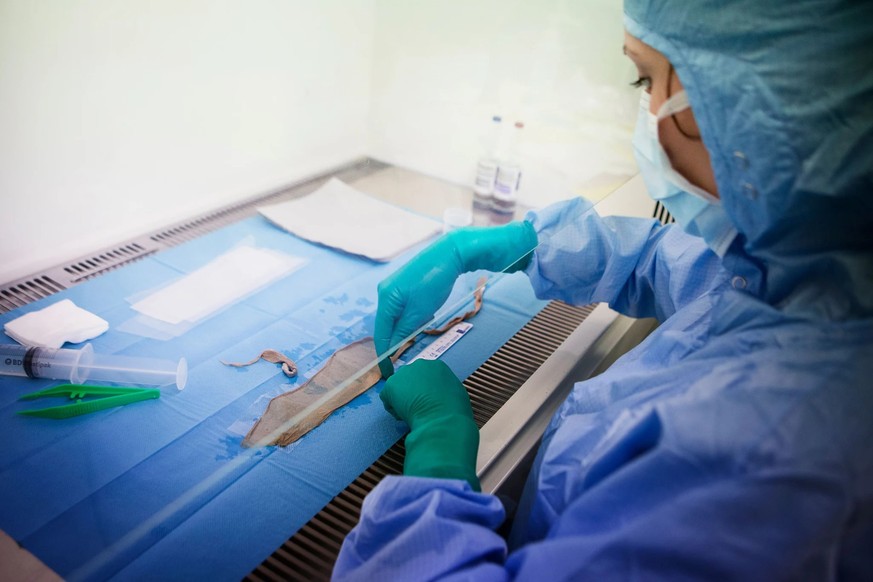 La peau provenant de banques de tissus sert de protection temporaire jusqu'à ce que suffisamment de peau autologue ait été cultivée.