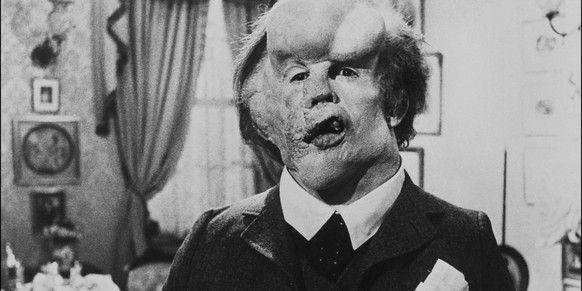 Elephant Man