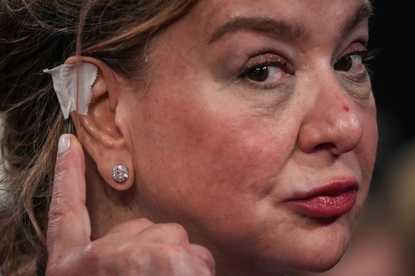 MILWAUKEE, WISCONSIN - JULY 16: An attendee points to her &quot;bandaged&quot; ear on the second day of the Republican National Convention at the Fiserv Forum on July 16, 2024 in Milwaukee, Wisconsin. ...