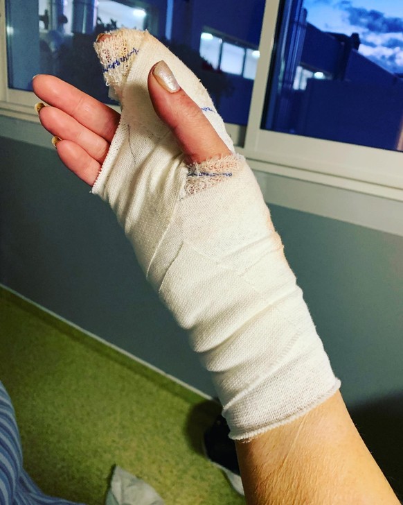 «Voilà l’état de ma main 🤚 j’ai eu très peur 😰», a t-elle écrit sur Instagram.
