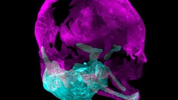 Le crâne d&#039;un embryon: ses os (en violet) se forment directement, sans passer par un stade préalable de cartilage.