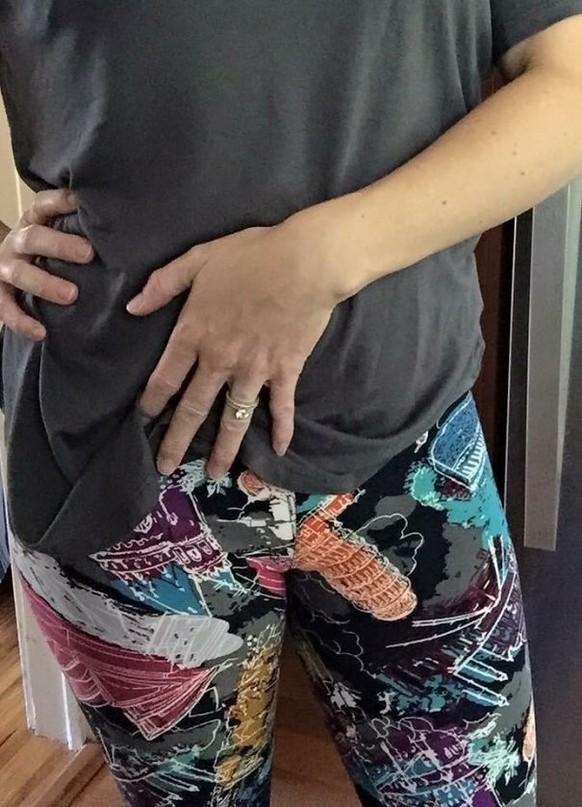 Lustige Kleider Fails: Pisa als Penis auf Shorts
