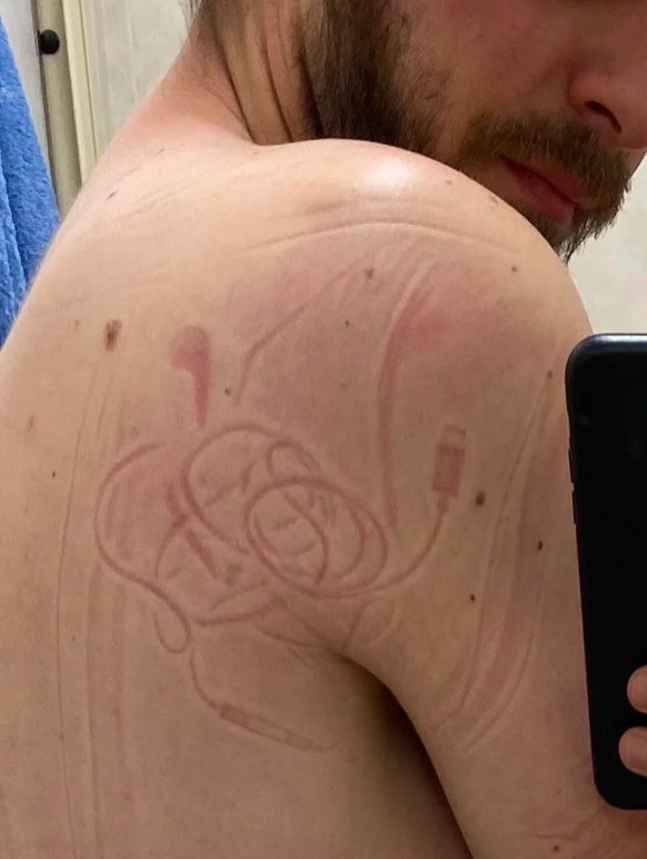 Die lustigsten Fails der Woche: Mittagsschlaf Abdrücke