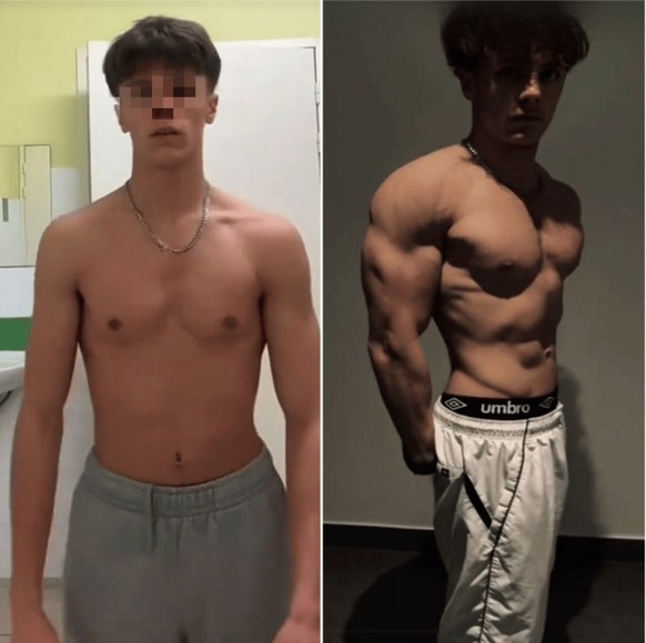 Le MK-677 garantit une prise de masse musculaire. Ce jeune homme affirme qu'il s'est écoulé deux mois entre la photo de gauche et celle de droite.