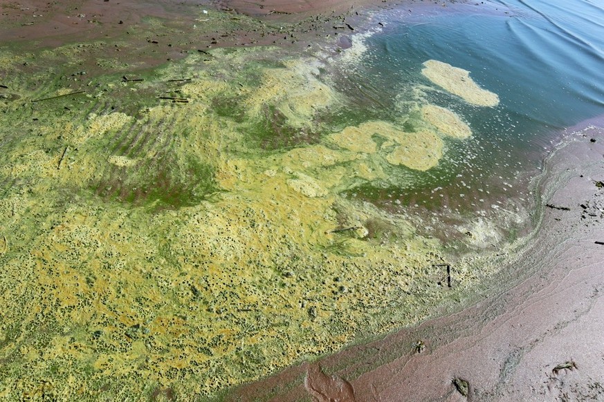 Cette bactérie présente dans nos lacs est très dangereuse