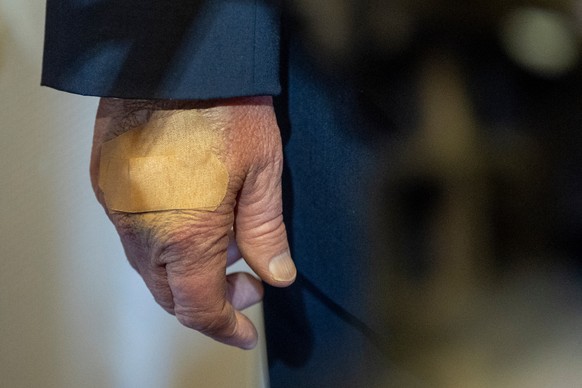 The right hand of President Donald Trump has a bandage on it as he speaks with reporters while in flight on Air Force One from his Mar-a-Lago estate in Palm Beach, Fla., to Joint Base Andrews, Sunday, ...