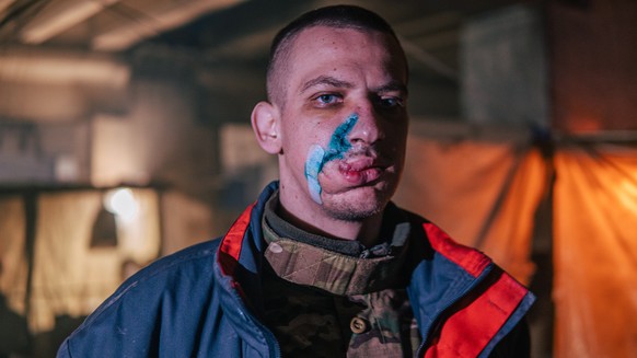 epa09940289 A handout picture made available by Regiment Azov press service shows an injured Ukrainian serviceman in a shelter at the Azovstal Iron and Steel Plant in Mariupol, Ukraine, 10 May 2022 (i ...