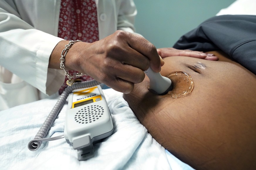 FILE - A doctor uses a hand-held Doppler probe on a pregnant woman to measure the heartbeat of the fetus on Dec. 17, 2021, in Jackson, Miss. As the first bills trickle in for Louisiana's upcoming ...
