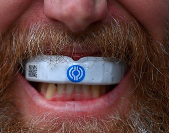 Le protège-dents connecté, une solution envisagée pour limiter les commotions cérébrales dans le rugby et les sports de contact.