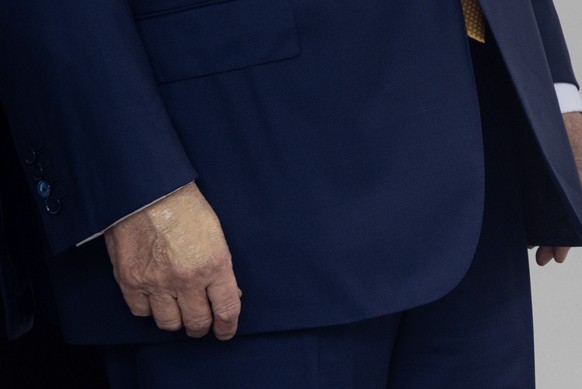 Le maquillage semblait dissimuler une zone de peau circulaire gonflée.