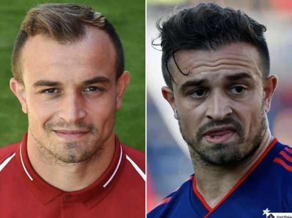 Xherdan Shaqiri (Chicago) avant/après.