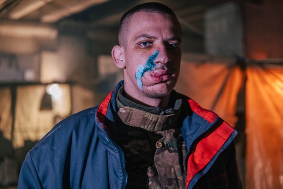 epa09940289 A handout picture made available by Regiment Azov press service shows an injured Ukrainian serviceman in a shelter at the Azovstal Iron and Steel Plant in Mariupol, Ukraine, 10 May 2022 (i ...