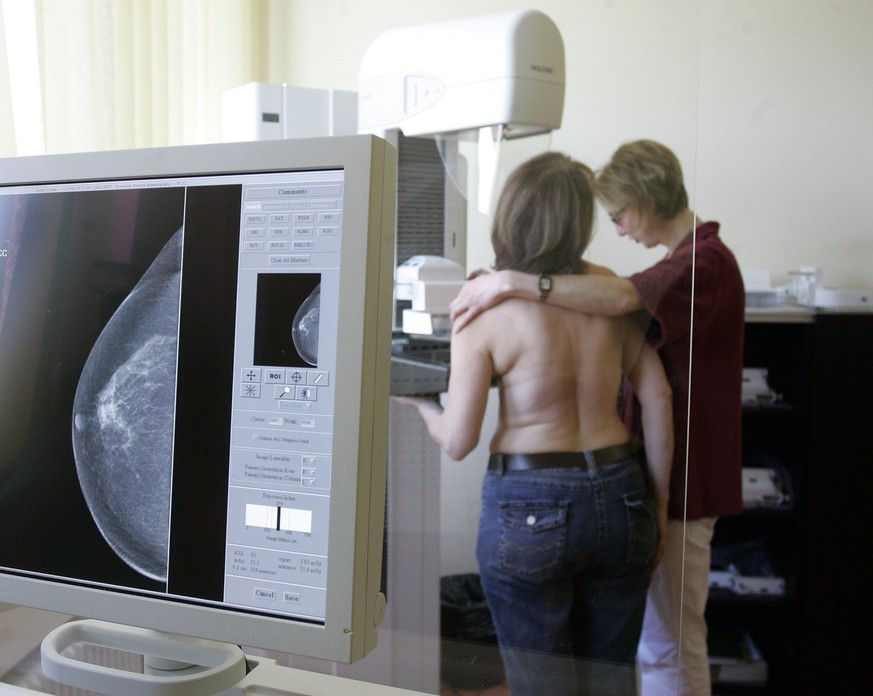 Eine Roentgenassistentin, rechts, und eine Medizinisch-Technische Assistentin, links, demonstrieren am 26. April 2007 das Mammographie Screening Programm in Berlin. Ein Streit um die beste Brustkrebs- ...