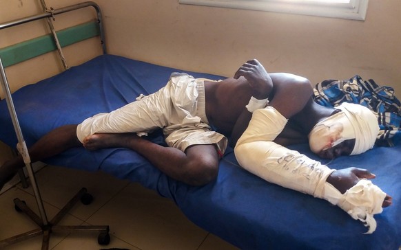 Saga Saganla, 30, from Diawely, lies on his bed at Somine Dolo hospital in Mopti, Mali, Friday June 24, 2022. Saganla survived an attack by nearly 100 jihadis on motorbikes who had gathered in his vil ...