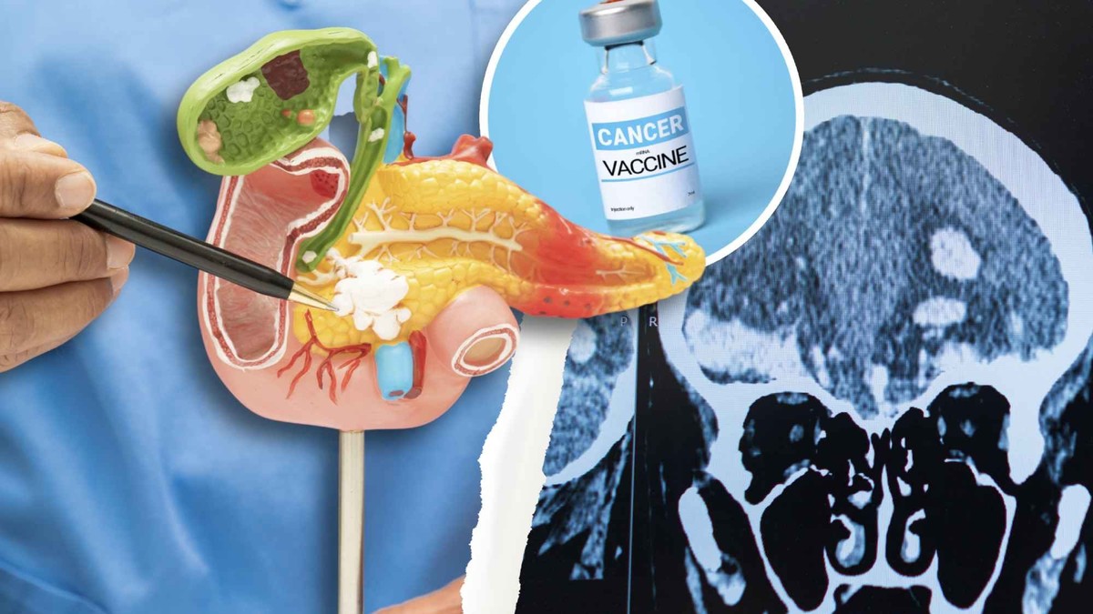 Un vaccin contre le cancer pourrait franchir une étape décisive