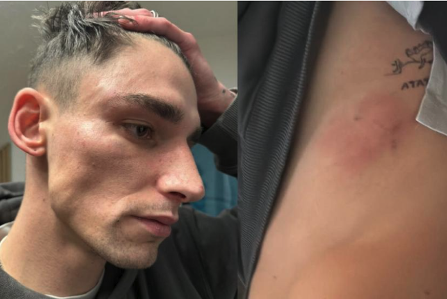 Les blessures de Pascal Kaiser, agressé pour la deuxième fois en trois jours. (DR)