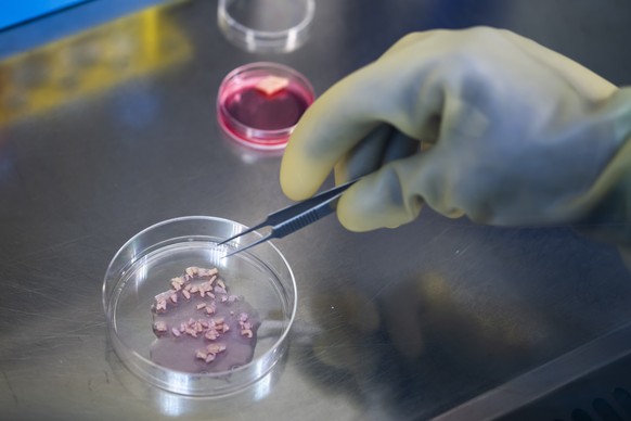 Fabienne, technicienne en analyse biomedicales au CHUV, disseque un morceau de peau afin de le multiplier et de le mettre en culture, ce jeudi 8 janvier 2026 au centre de production cellulaire du CHUV ...