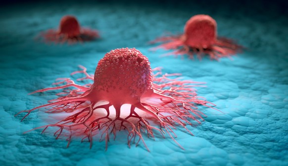 Lors de l'apparition d'un cancer, des cellules normales de l'organisme se modifient et deviennent des cellules tumorales. Elles se multiplient de manière incontrôlée et envahissent les tissus sains.