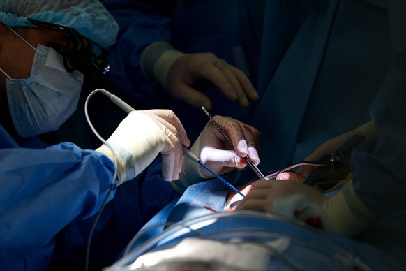 RUSSIA, BELGOROD - MARCH 11, 2025: Medical staff perform minimally invasive video-assisted mitral valve plasty at St Joasaph Regional Clinical Hospital. Anton Vergun/TASS PUBLICATIONxINxGERxAUTxONLY 7 ...